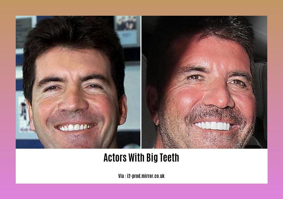 Actors with big teeth