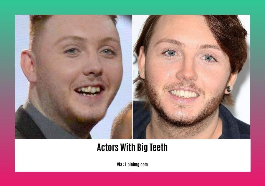 Actors with big teeth