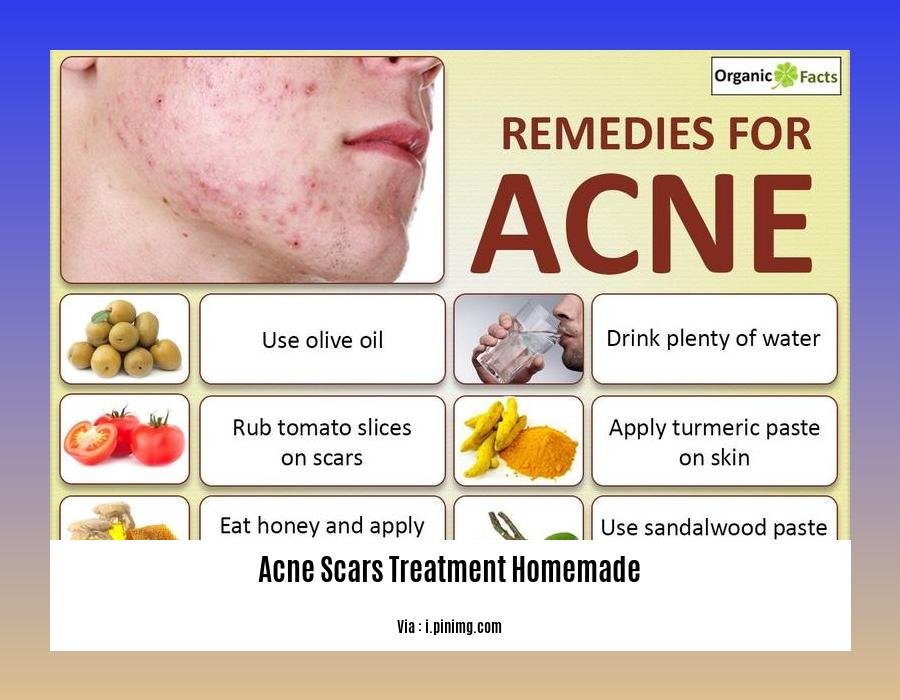 acne scars treatment homemade
