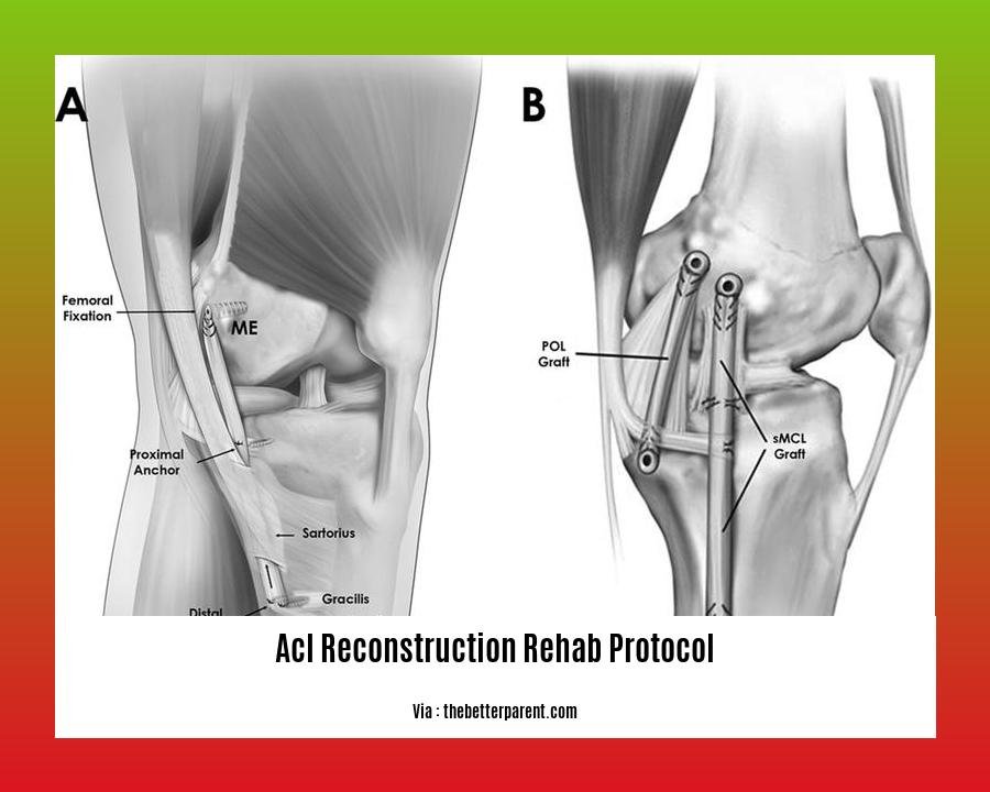 acl reconstruction rehab protocol