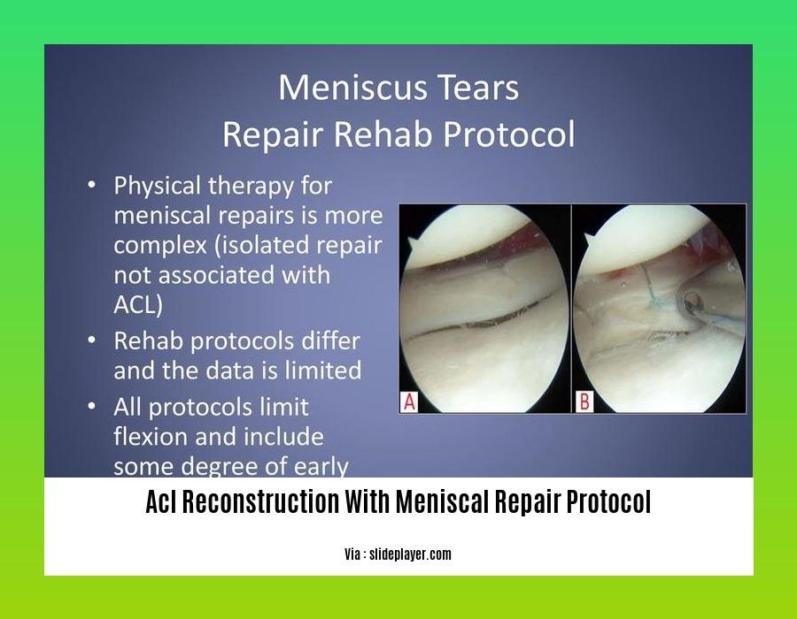 acl reconstruction with meniscal repair protocol