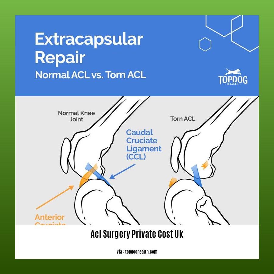 acl surgery private cost uk