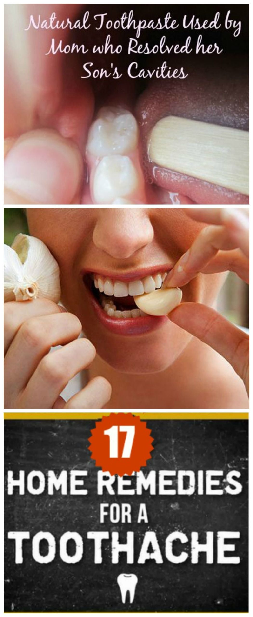 best home remedy for infected tooth