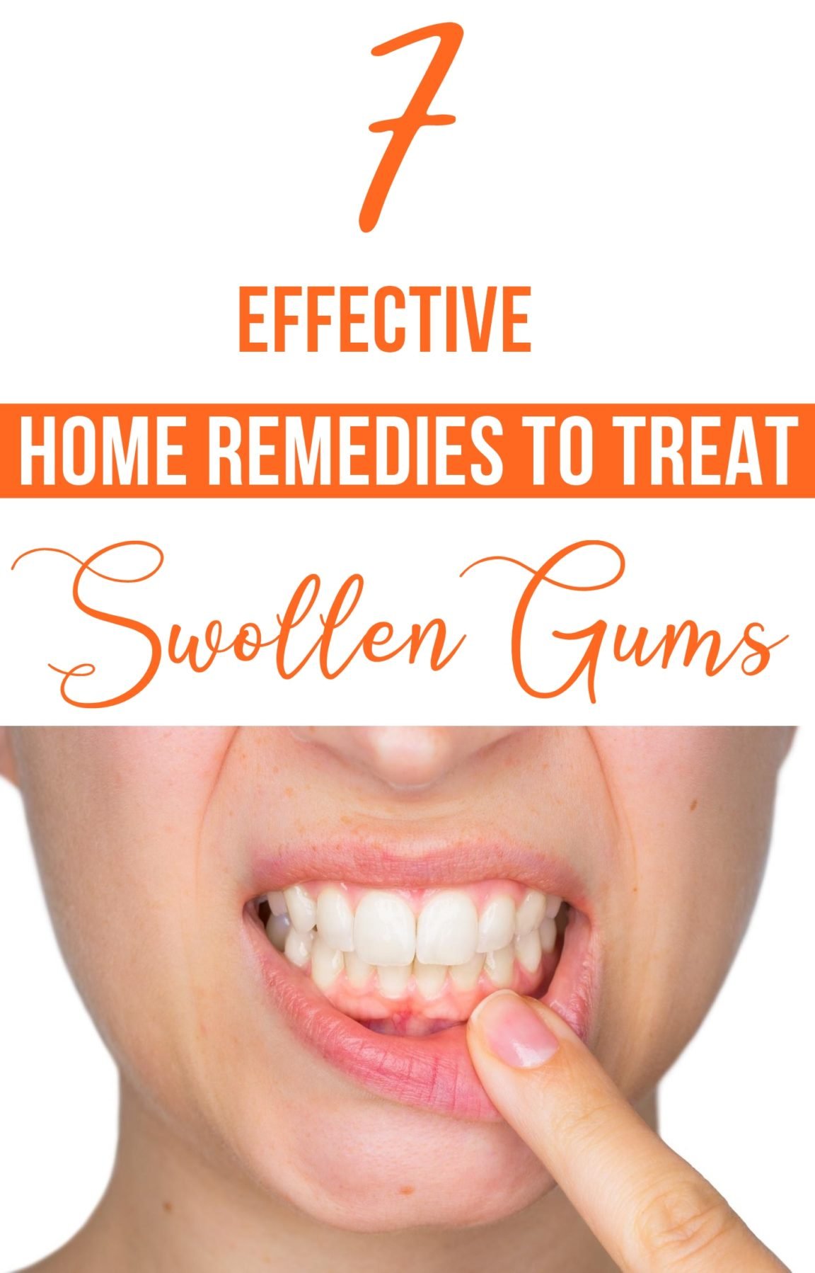 home remedies for gum infection