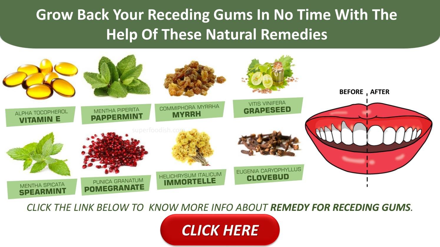 home remedies for gum sores