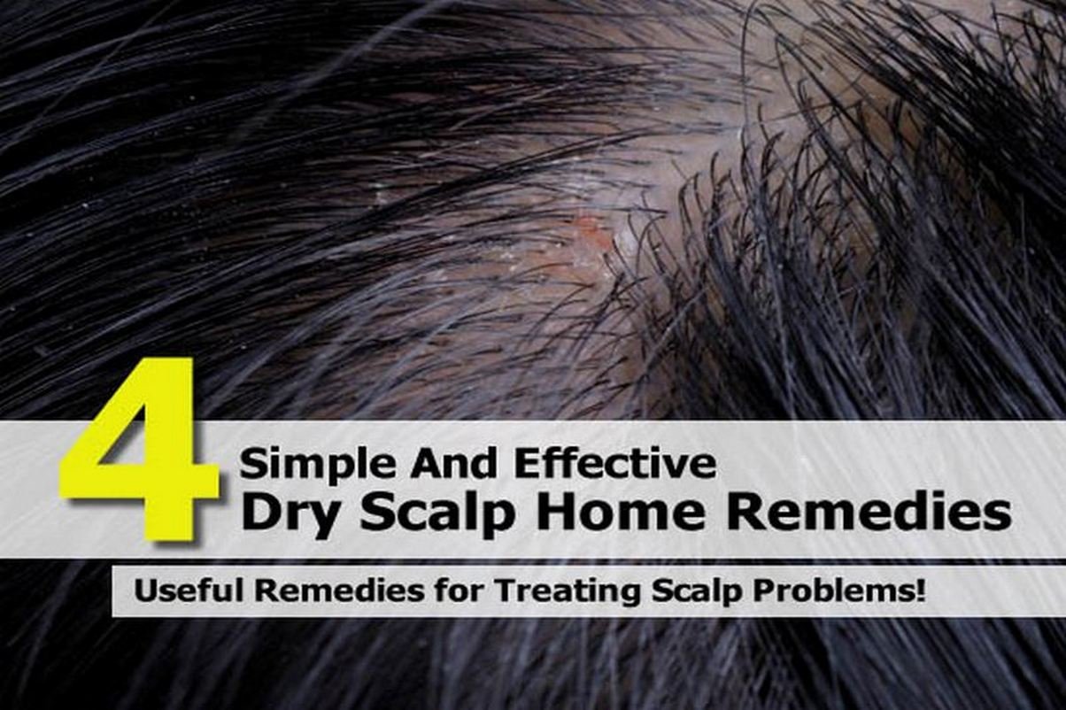 home remedies for scalp sores